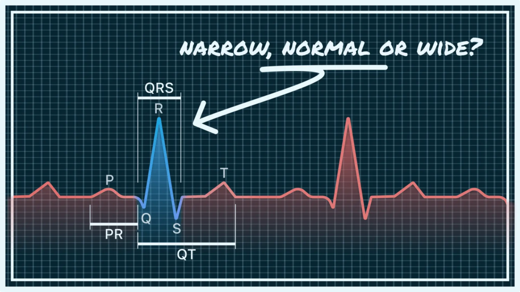 Normal PR Interval